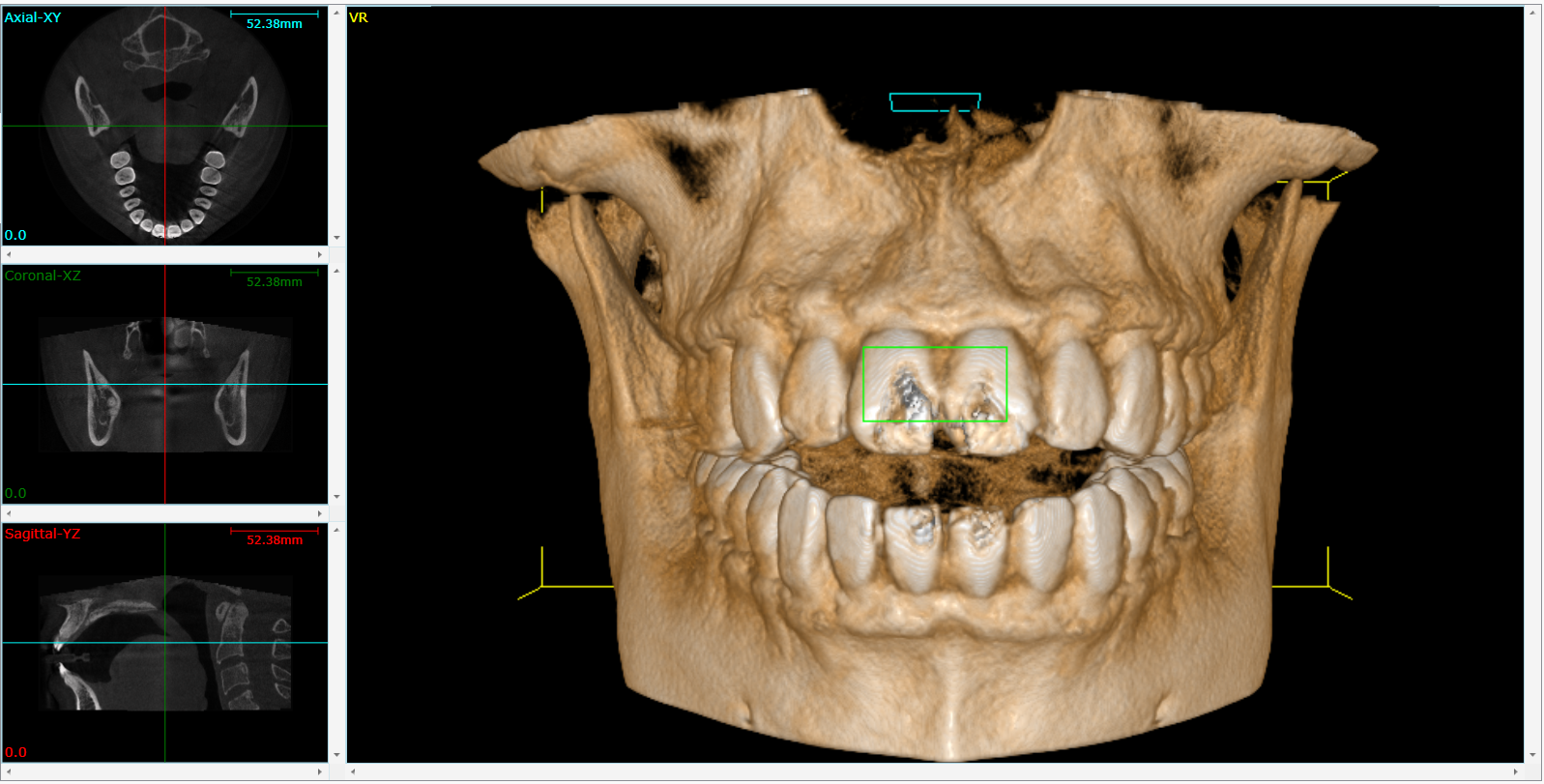 Cone Beam 3D Imaging Bellingham, WA
