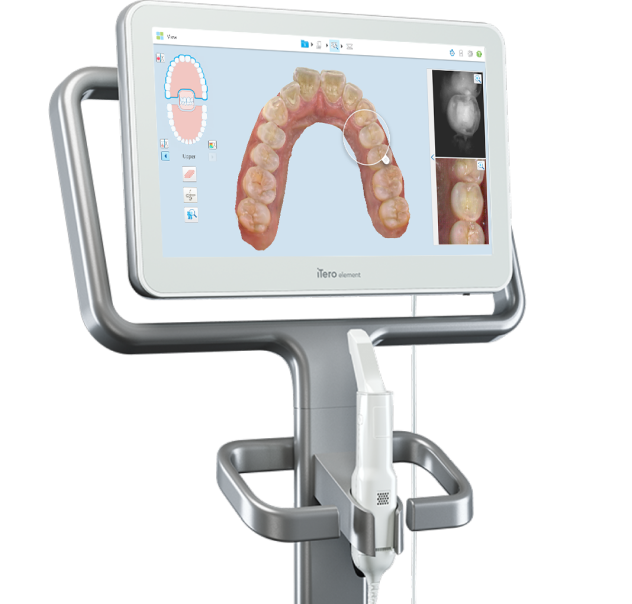 iTero 3D Scanner